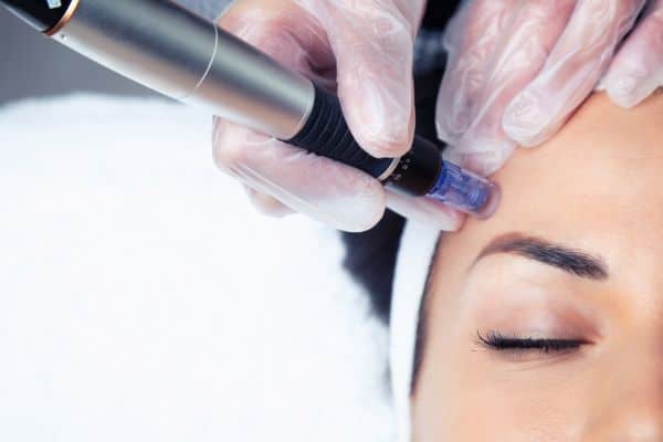 Explaining Total Skin Tightening Treatment and What to Expect 2 What Skin Concerns Can Total Skin Tightening Treatment Help With Batley?