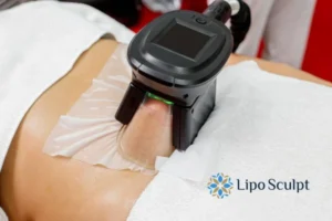 Does Fat Freezing At Home Work? 3 Fat freezing at home from Lipo Sculpt Batley